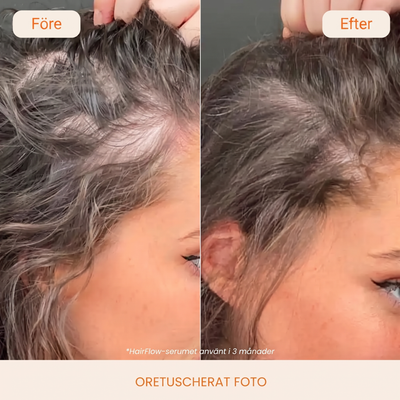 Före och efter på bena och hårbotten efter tre månader med HairFlow, oretuscherat foto